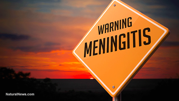 meningitis_(c)_LAB_Ocamb