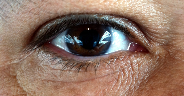 eye_social_media_by_Tony_Alter_Attribution_2_point_0_Generic_CC_BY_2_point_0